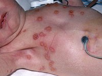 newborn_diagnosis84327.jpg