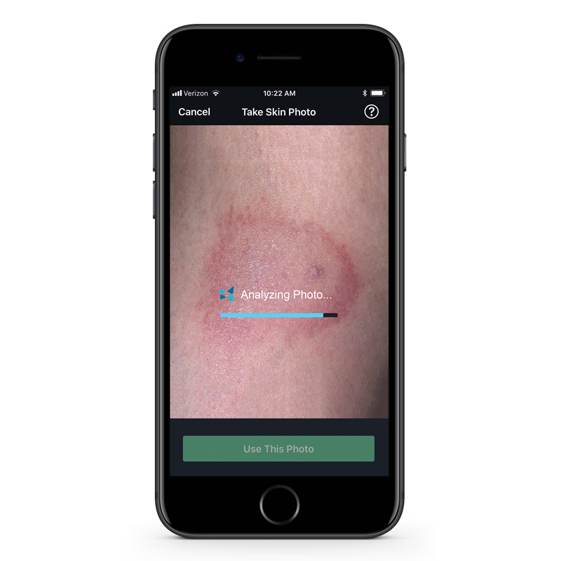 Coronavirus (COVID-19): What You Need to Know