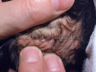 Clinical image of Cutis verticis gyrata - imageId=1411007. Click to open in gallery. 