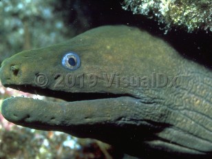Organism image of Moray eel bite - imageId=293888. Click to open in gallery.  caption: 'A Pacific green moray eel.'