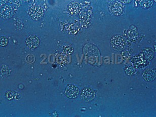 Lab image of Trichomoniasis - imageId=311490. Click to open in gallery.  caption: '<i>T vaginalis</i> seen on a wet mount (oval structure).'