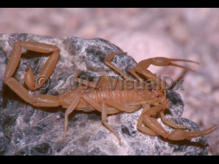 Organism image of Scorpion sting