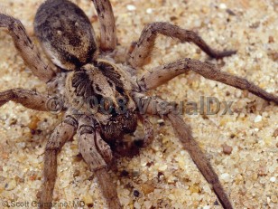 Organism image of Wolf spider envenomation - imageId=3860323. Click to open in gallery.  caption: 'A wolf spider (<i>Lycosa</i> spp.).'