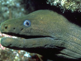 Organism image of Moray eel bite - imageId=293888. Click to open in gallery.  caption: 'A Pacific green moray eel.'