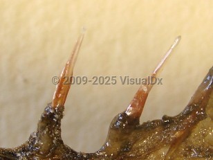 Organism image of Stonefish spine puncture - imageId=3971917. Click to open in gallery.  caption: 'The spines of a stonefish.'