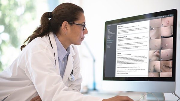 A woman in a white lab coat looks at VisualDx on her computer screen.