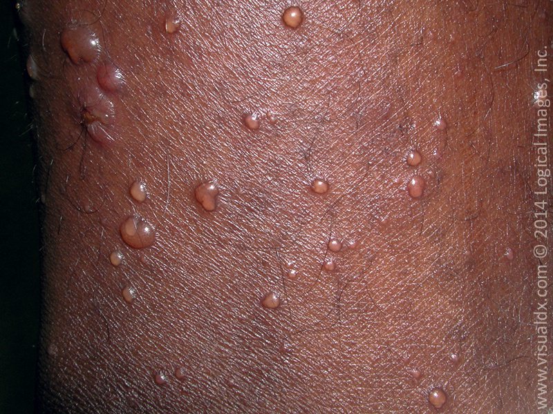 Making Rash Decisions How Dermatologists Think VisualDx