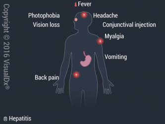 Viral Hemorrhagic Fevers | VisualDx