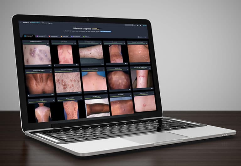 Laptop showing medical images from the VisualDx dermatology atlas