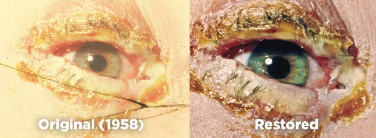 An original medical image on the left and the professionally restored image on the right