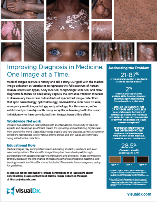 VisualDx's leading dermatology atlas includes 28.5% dark skin images