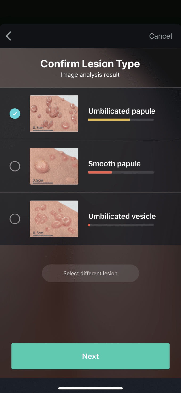 A selection of lesion types on DermExpert