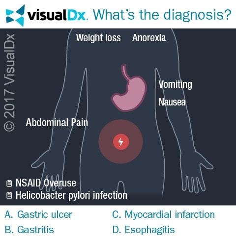 Man Vomits Blood In Er After Switching Pain Meds Can You Diagnose