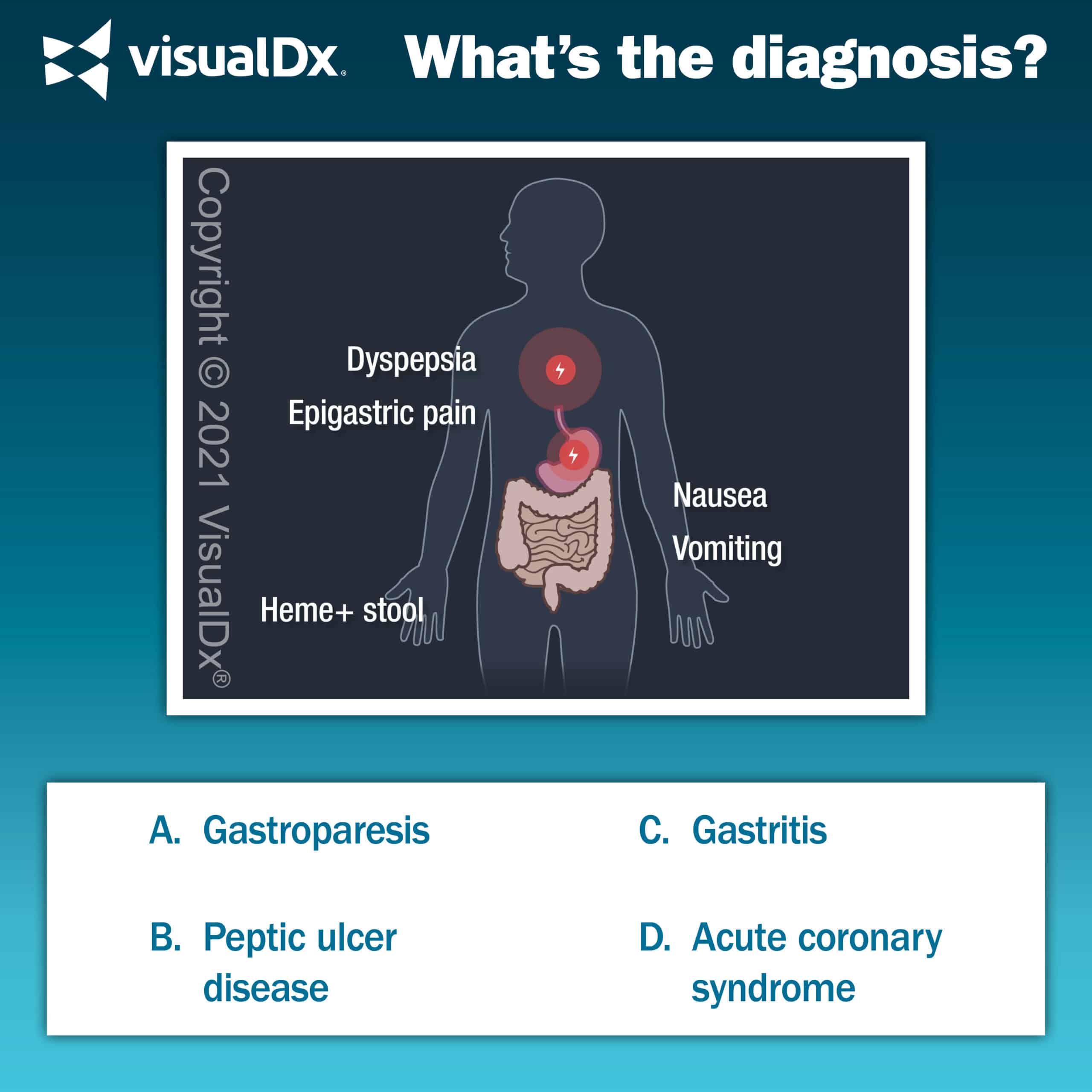 Spicy Food Causing Nausea, Dyspepsia Let’s Diagnose