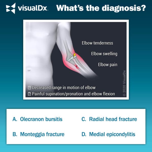 Man Has Elbow Pain, Edema Following Fall – Let’s Diagnose