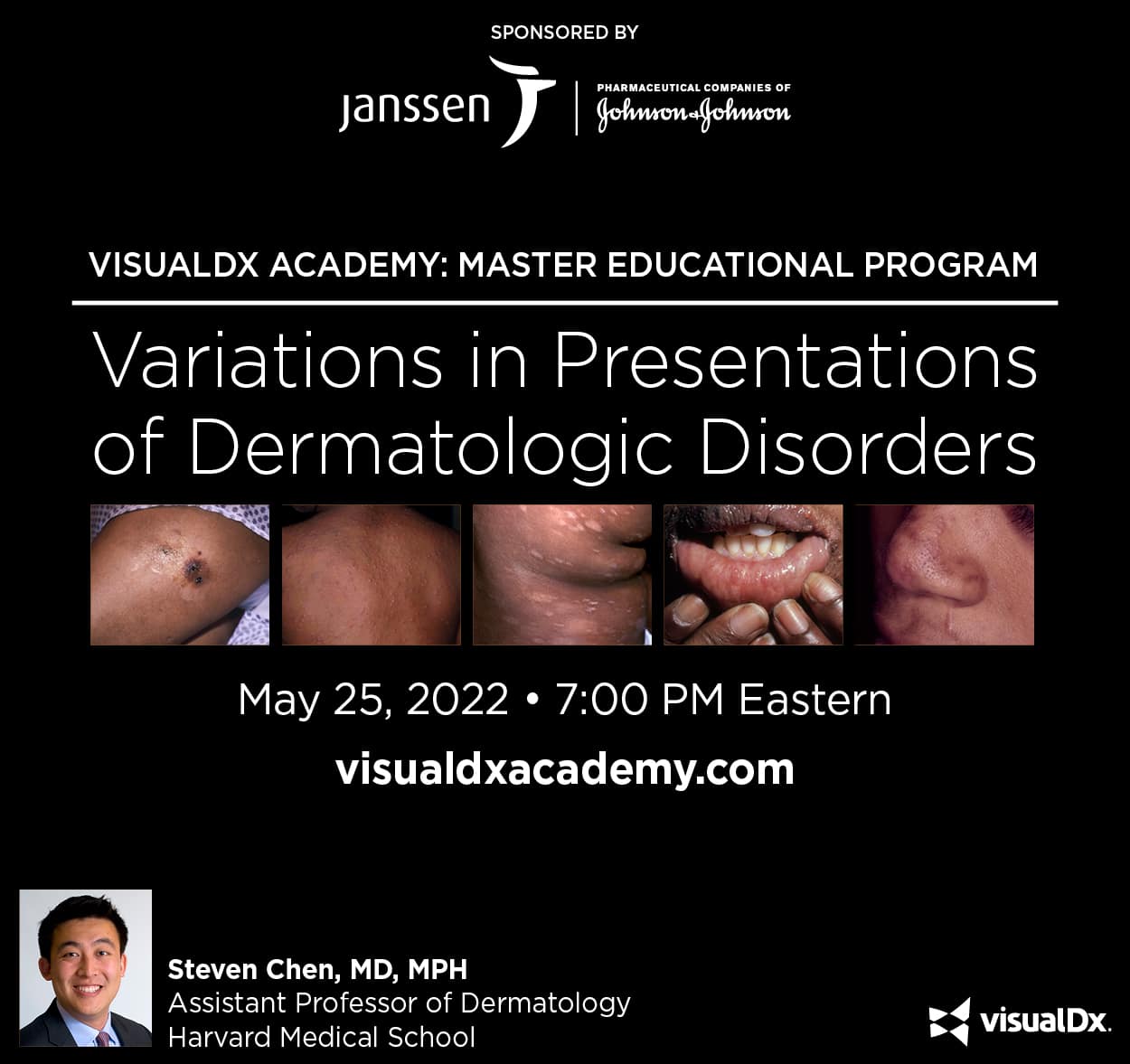 VisualDx Academy: Variations in Presentations of Dermatologic Disorders
