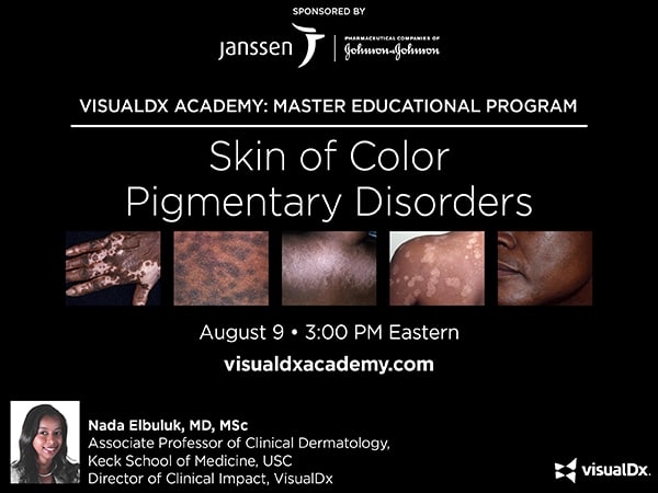VisualDx Academy: Skin of Color Pigmentary Disorders